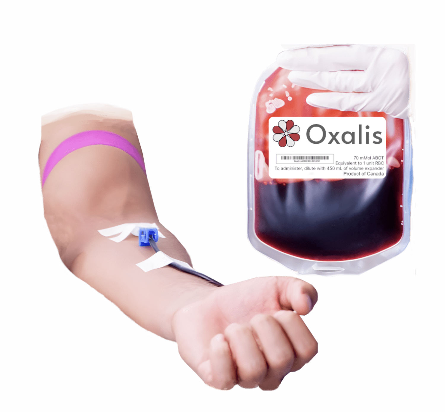 Oxalis